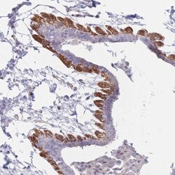 SLC7A6 Antibody, Novus Biologicals 0.1mL; Unlabeled:Antibodies, Polyclonal